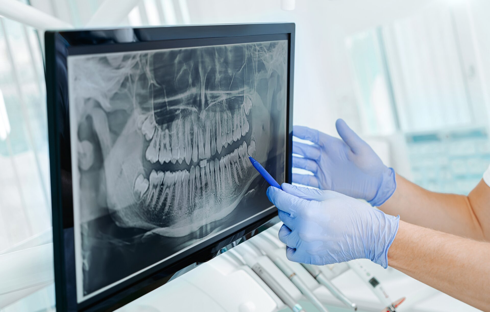 stock-photo-hands-doctor-dentist-in-gloves-show-the-teeth-on-x-ray-on-digital-screen-in-dental-clinic-on-light-1798261573
